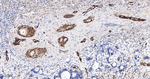 TAGLN Antibody in Immunohistochemistry (Paraffin) (IHC (P))