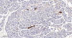 TAGLN Antibody in Immunohistochemistry (Paraffin) (IHC (P))