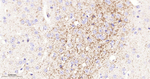 DCP1A Antibody in Immunohistochemistry (Paraffin) (IHC (P))