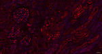 DCP1A Antibody in Immunohistochemistry (Paraffin) (IHC (P))