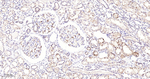 DCP1A Antibody in Immunohistochemistry (Paraffin) (IHC (P))