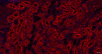 DCP1A Recombinant Rabbit Monoclonal Antibody (8G6)