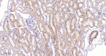 DCP1A Antibody in Immunohistochemistry (Paraffin) (IHC (P))
