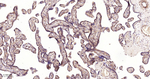DCP1A Antibody in Immunohistochemistry (Paraffin) (IHC (P))