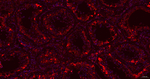 DCP1A Antibody in Immunohistochemistry (Paraffin) (IHC (P))