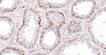 DCP1A Antibody in Immunohistochemistry (Paraffin) (IHC (P))