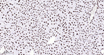 hnRNP U Antibody in Immunohistochemistry (Paraffin) (IHC (P))