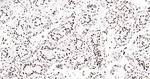 hnRNP U Antibody in Immunohistochemistry (Paraffin) (IHC (P))