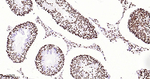 hnRNP U Antibody in Immunohistochemistry (Paraffin) (IHC (P))