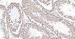 hnRNP U Antibody in Immunohistochemistry (Paraffin) (IHC (P))