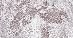 hnRNP U Antibody in Immunohistochemistry (Paraffin) (IHC (P))