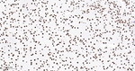 hnRNP U Antibody in Immunohistochemistry (Paraffin) (IHC (P))