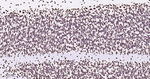 hnRNP U Antibody in Immunohistochemistry (Paraffin) (IHC (P))