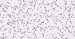 hnRNP U Antibody in Immunohistochemistry (Paraffin) (IHC (P))
