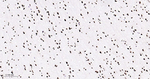 hnRNP U Antibody in Immunohistochemistry (Paraffin) (IHC (P))