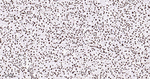 hnRNP U Antibody in Immunohistochemistry (Paraffin) (IHC (P))