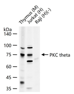 PKC theta Recombinant Rabbit Monoclonal Antibody (7H5)