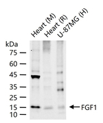 FGF1 Recombinant Rabbit Monoclonal Antibody (6H8)