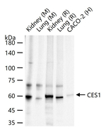CES1 Recombinant Rabbit Monoclonal Antibody (13E4)