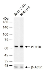 PTH1R Antibody in Western Blot (WB)