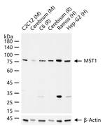 MSP Recombinant Rabbit Monoclonal Antibody (4B1)