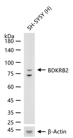 BDKRB2 Recombinant Rabbit Monoclonal Antibody (4D8)