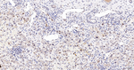 Cullin 4A Antibody in Immunohistochemistry (Paraffin) (IHC (P))