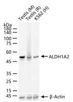 ALDH1A2 Recombinant Rabbit Monoclonal Antibody (9D9)