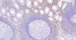 CD162 Antibody in Immunohistochemistry (Paraffin) (IHC (P))