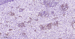 CD162 Antibody in Immunohistochemistry (Paraffin) (IHC (P))