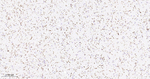 CD162 Antibody in Immunohistochemistry (Paraffin) (IHC (P))