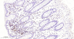 CD162 Antibody in Immunohistochemistry (Paraffin) (IHC (P))