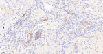 CD162 Antibody in Immunohistochemistry (Paraffin) (IHC (P))