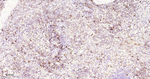 CD162 Antibody in Immunohistochemistry (Paraffin) (IHC (P))
