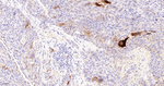 Galectin 7 Recombinant Rabbit Monoclonal Antibody (11A1)
