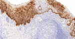 Galectin 7 Antibody in Immunohistochemistry (Paraffin) (IHC (P))
