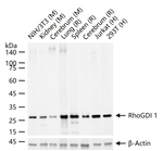 RhoGDI Recombinant Rabbit Monoclonal Antibody (11D12)