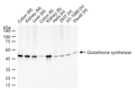 GSS Recombinant Rabbit Monoclonal Antibody (3H3)