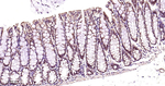 PSMD4 Antibody in Immunohistochemistry (Paraffin) (IHC (P))
