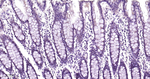 PSMD4 Antibody in Immunohistochemistry (Paraffin) (IHC (P))