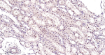 PSMD4 Antibody in Immunohistochemistry (Paraffin) (IHC (P))