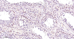 PSMD4 Antibody in Immunohistochemistry (Paraffin) (IHC (P))