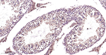 PSMD4 Antibody in Immunohistochemistry (Paraffin) (IHC (P))