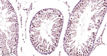 PSMD4 Antibody in Immunohistochemistry (Paraffin) (IHC (P))