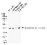 DRD3 Recombinant Rabbit Monoclonal Antibody (2C2)