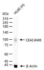 CEACAM6 Recombinant Rabbit Monoclonal Antibody (11F3)