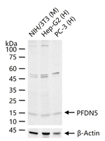 PFDN5 Recombinant Rabbit Monoclonal Antibody (11D2)