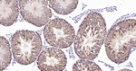 CAS Antibody in Immunohistochemistry (Paraffin) (IHC (P))