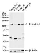 CAS Antibody in Western Blot (WB)