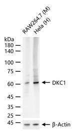 DKC1 Recombinant Rabbit Monoclonal Antibody (4A9)